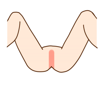 IC