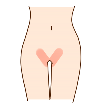 VC